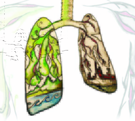 Les deux côtés des poumons
