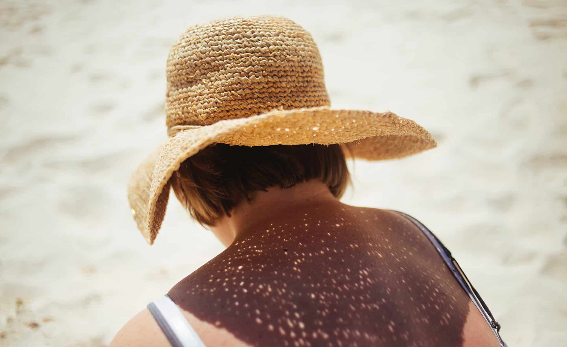 Protégez-vous des bains de soleil en vous ombrageant avec de la crème solaire et un chapeau de soleil